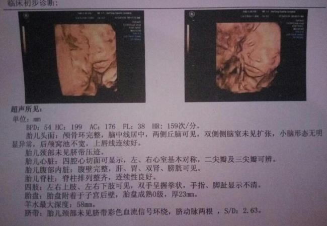 6个月四维女孩却生了男孩 孕妈们别信了